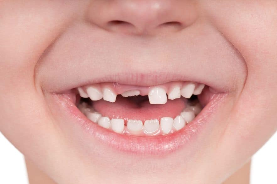 Ein neues Medikament kann Zähne nachwachsen lassen